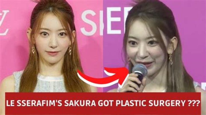 Did Sakura Get Plastic Surgery? Breaking Down the Debate