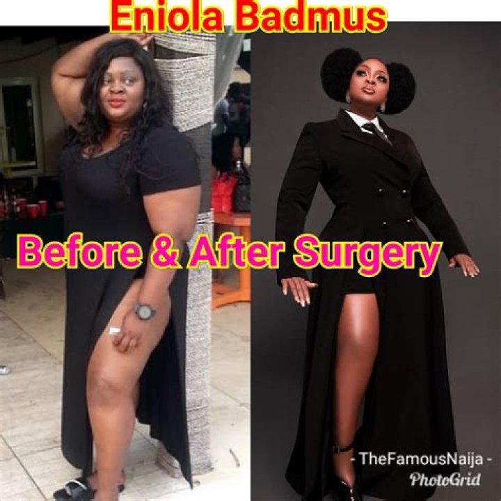 Eniola Badmus Weight Loss, Before And After Surgery Photos - SarkariResult