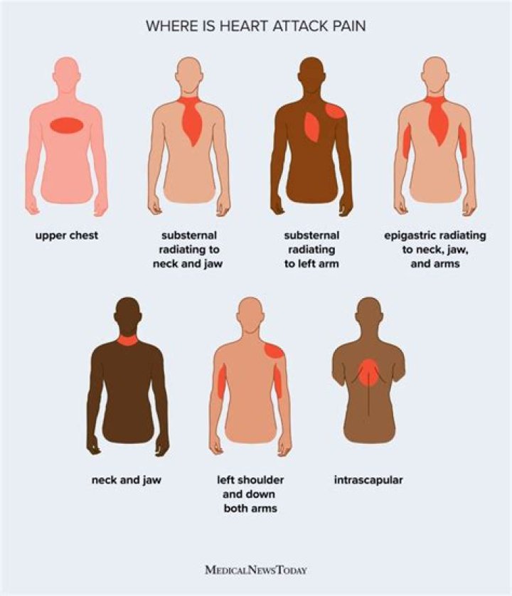 Iain Purslow Death Cause And Obituary, Iain Purslow Dies Of Heart Attack - SarkariResult