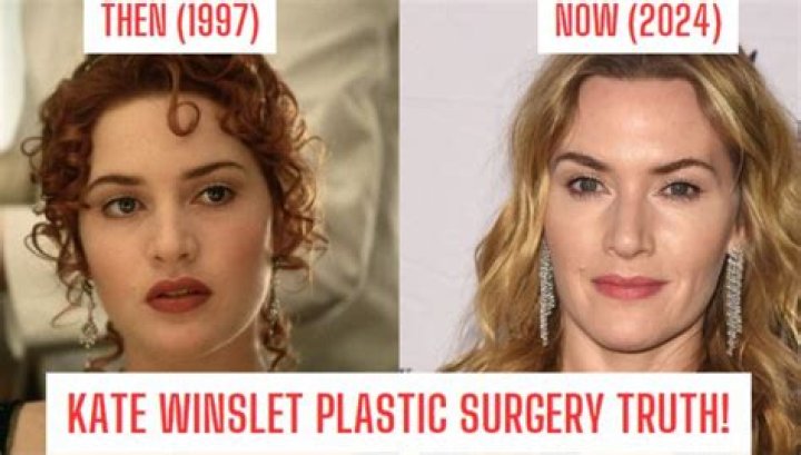 Kate Winslet: Did She Undergo Plastic Surgery? Getting to Know Kate Winslet - SarkariResult