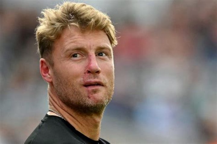 What happened to Andrew Flintoff Face? Andrew Flintoff Facial Injury Update - News